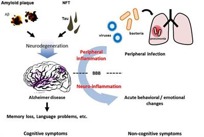 Systemic inflammation, blood-brain barrier vulnerability and cognitive / non-cognitive symptoms in Alzheimer disease: Relevance to pathogenesis and therapy